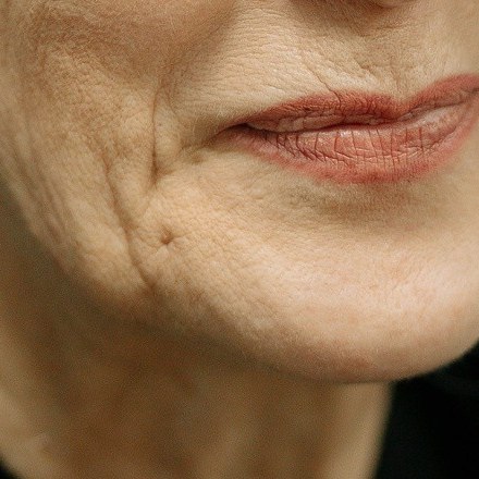 Real photo: a close-up of an older woman’s lips and chin, with creases of different depths and skin that changes texture across the face
